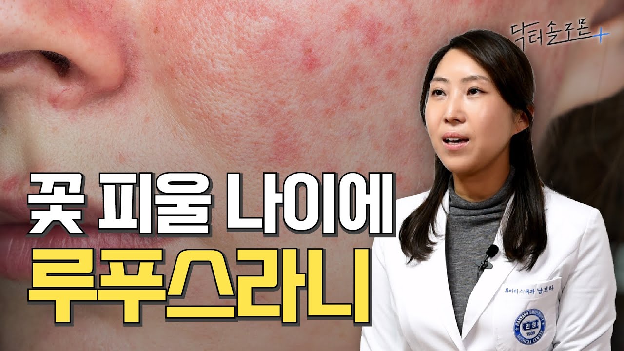 루푸스의 모든 것